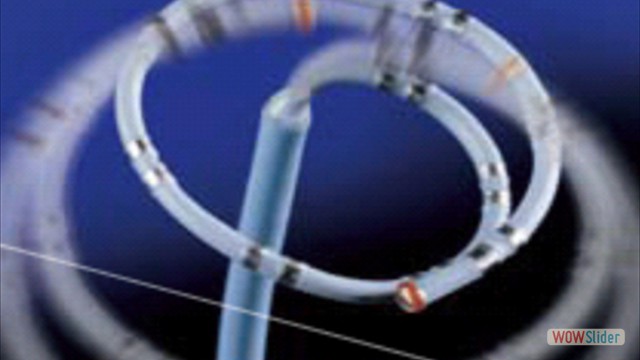 קטטר Lasso